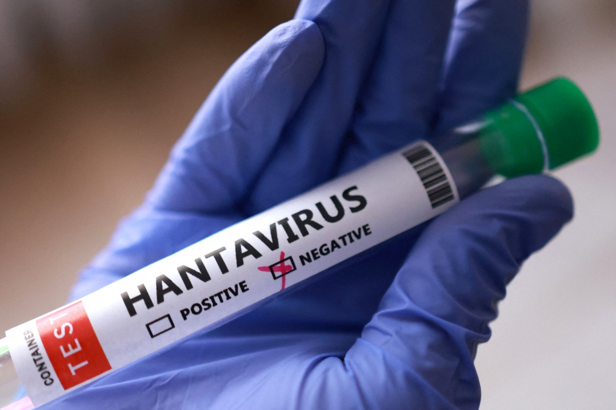 Meski DIY nihil kasus Hantavirus di 2026, Dinkes tetap perketat pengawasan.