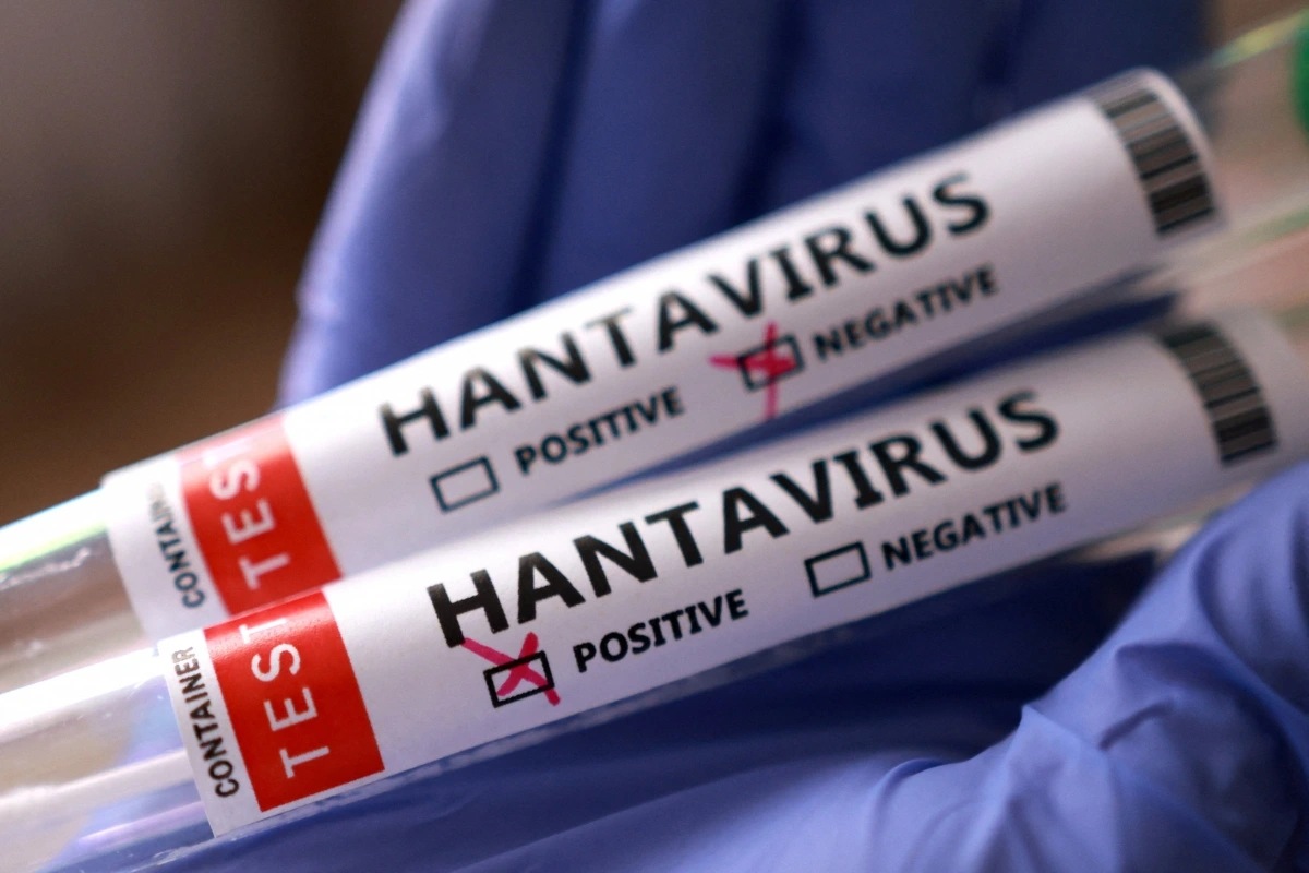 Anggota Komisi IX DPR RI, Netty Aher angkat suara soal munculnya kasus Hantavirus, minta pemerintah tingkatkan kewaspadaan.